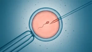 fertilização in vitro